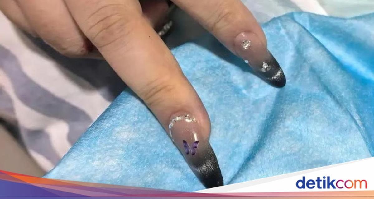 Kisah Unik Dari China, Ahli Manikur Bantu Medis Tangani Pasien