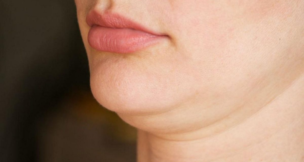 Double Chin Bikin Sebal Karena Mengganggu Penampilan