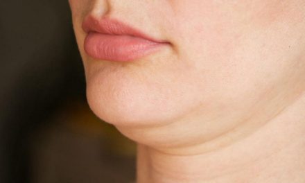 Double Chin Bikin Sebal Karena Mengganggu Penampilan