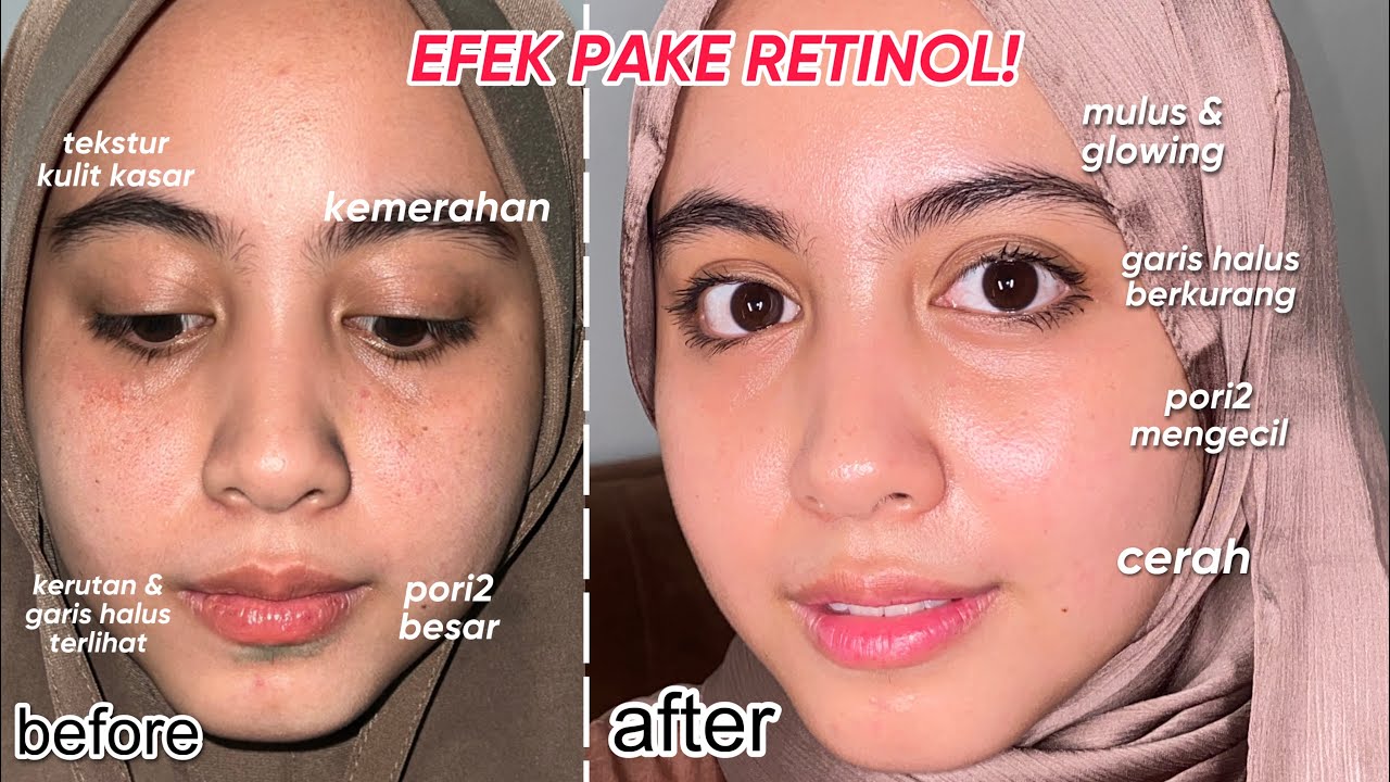 Ketahui Pentingnya